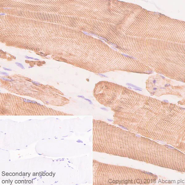 Immunohistochemistry (Formalin/PFA-fixed paraffin-embedded sections) - Anti-Desmin antibody [SP138] - BSA and Azide free (AB243931)