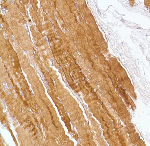 Immunohistochemistry (Formalin/PFA-fixed paraffin-embedded sections) - Anti-Desmin antibody [SP138] - BSA and Azide free (AB243931)