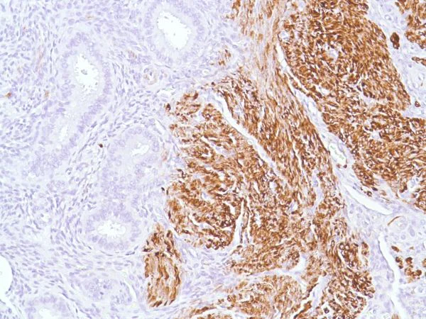 Immunohistochemistry (Formalin/PFA-fixed paraffin-embedded sections) - Anti-Desmin antibody [SP138] - BSA and Azide free (AB243931)