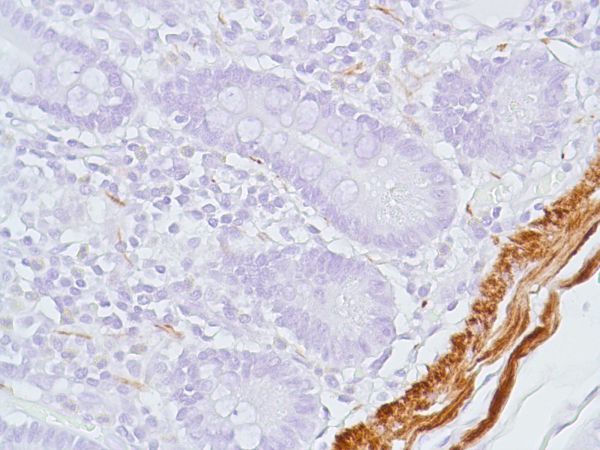 Immunohistochemistry (Formalin/PFA-fixed paraffin-embedded sections) - Anti-Desmin antibody [SP138] - BSA and Azide free (AB243931)
