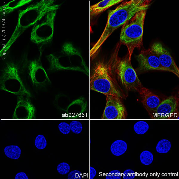 Immunocytochemistry/ Immunofluorescence - Anti-Desmin antibody [SP138] - C-terminal (AB227651)