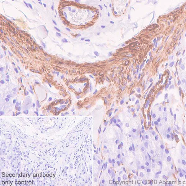 Immunohistochemistry (Formalin/PFA-fixed paraffin-embedded sections) - Anti-Desmin antibody [SP138] - C-terminal (AB227651)