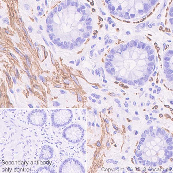 Immunohistochemistry (Formalin/PFA-fixed paraffin-embedded sections) - Anti-Desmin antibody [SP138] - C-terminal (AB227651)