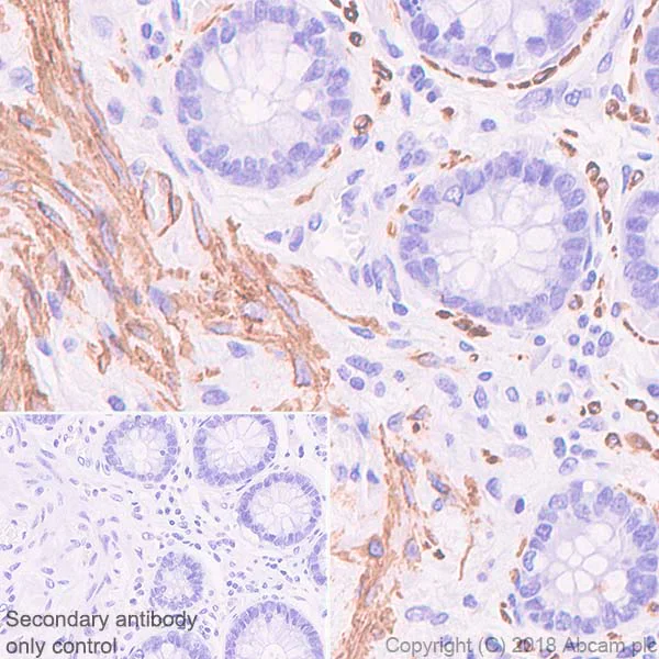 Immunohistochemistry (Formalin/PFA-fixed paraffin-embedded sections) - Anti-Desmin antibody [SP138] - C-terminal (AB227651)