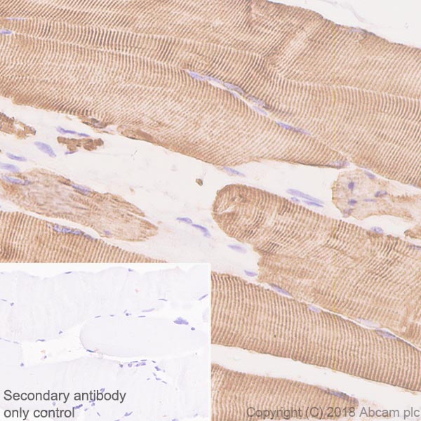 Immunohistochemistry (Formalin/PFA-fixed paraffin-embedded sections) - Anti-Desmin antibody [SP138] - C-terminal (AB227651)