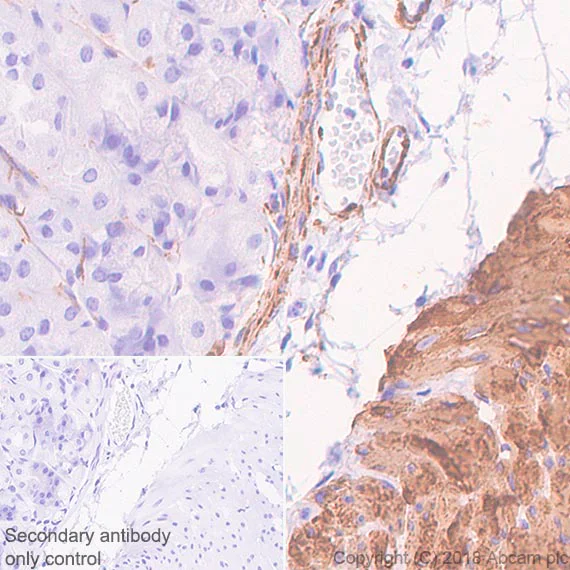 Immunohistochemistry (Formalin/PFA-fixed paraffin-embedded sections) - Anti-Desmin antibody [SP138] - C-terminal (AB227651)