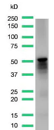 Western blot - Anti-Desmin antibody [SP138] - C-terminal (AB227651)