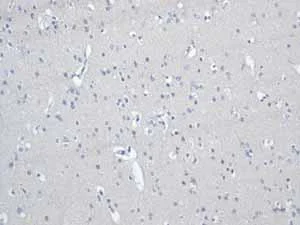 Immunohistochemistry (Formalin/PFA-fixed paraffin-embedded sections) - Anti-Desmin antibody [Y66] - BSA and Azide free (AB271829)