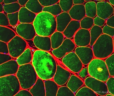 Immunocytochemistry/ Immunofluorescence - Anti-Desmin antibody [Y66] - Cytoskeleton Marker (AB32362), expandable thumbnail