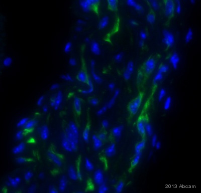 Immunocytochemistry/ Immunofluorescence - Anti-Desmin antibody [Y66] - Cytoskeleton Marker (ab32362), expandable thumbnail
