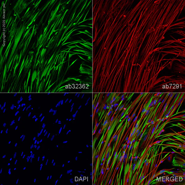 Immunocytochemistry/ Immunofluorescence - Anti-Desmin antibody [Y66] - Cytoskeleton Marker (AB32362)