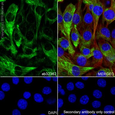 Immunocytochemistry/ Immunofluorescence - Anti-Desmin antibody [Y66] - Cytoskeleton Marker (ab32362), expandable thumbnail