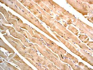 Immunohistochemistry (Formalin/PFA-fixed paraffin-embedded sections) - Anti-Desmin antibody [Y66] - Cytoskeleton Marker (AB32362)
