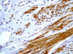 Immunohistochemistry (Formalin/PFA-fixed paraffin-embedded sections) - Anti-Desmin antibody [Y66] - Cytoskeleton Marker (ab32362), expandable thumbnail