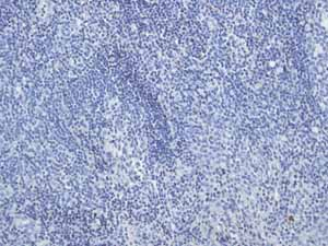 Immunohistochemistry (Formalin/PFA-fixed paraffin-embedded sections) - Anti-Desmin antibody [Y66] - Cytoskeleton Marker (ab32362), expandable thumbnail