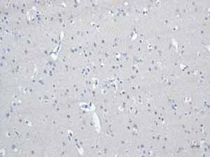 Immunohistochemistry (Formalin/PFA-fixed paraffin-embedded sections) - Anti-Desmin antibody [Y66] - Cytoskeleton Marker (ab32362), expandable thumbnail