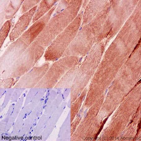 Immunohistochemistry (Formalin/PFA-fixed paraffin-embedded sections) - Anti-Desmin antibody [Y66] - Cytoskeleton Marker (AB32362), expandable thumbnail