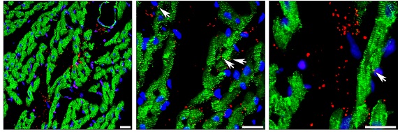 Immunohistochemistry (Formalin/PFA-fixed paraffin-embedded sections) - Anti-Desmin antibody [Y66] - Cytoskeleton Marker (AB32362), expandable thumbnail