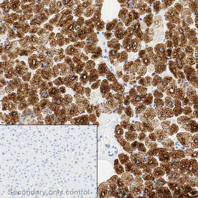 Immunohistochemistry (Formalin/PFA-fixed paraffin-embedded sections) - Anti-Desmin antibody [Y66] - Cytoskeleton Marker (AB32362)