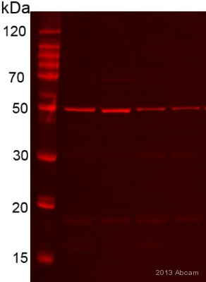 Western blot - Anti-Desmin antibody [Y66] - Cytoskeleton Marker (ab32362), expandable thumbnail
