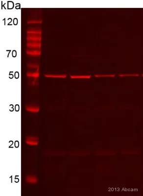 Western blot - Anti-Desmin antibody [Y66] - Cytoskeleton Marker (AB32362)