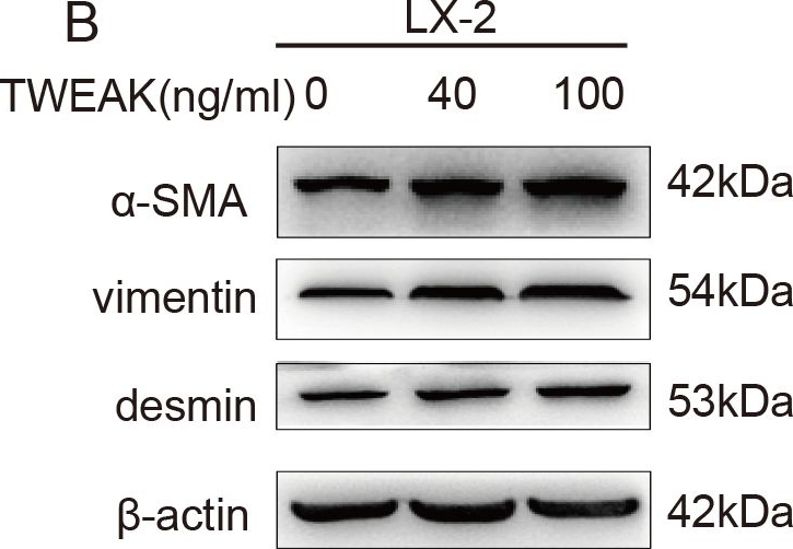 Western blot - Anti-Desmin antibody [Y66] - Cytoskeleton Marker (ab32362), expandable thumbnail
