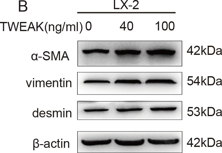 Western blot - Anti-Desmin antibody [Y66] - Cytoskeleton Marker (AB32362)