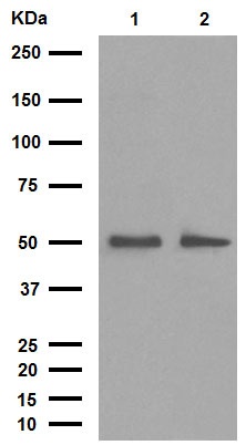 Western blot - Anti-Desmin antibody [Y66] - Cytoskeleton Marker (ab32362), expandable thumbnail