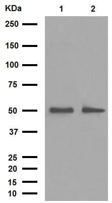 Western blot - Anti-Desmin antibody [Y66] - Cytoskeleton Marker (AB32362)