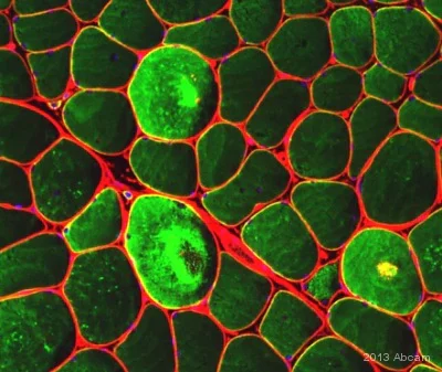 Immunocytochemistry/ Immunofluorescence - Anti-Desmin antibody [Y66] - Low endotoxin, Azide free (AB216616)