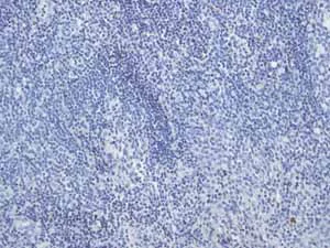 Immunohistochemistry (Formalin/PFA-fixed paraffin-embedded sections) - Anti-Desmin antibody [Y66] - Low endotoxin, Azide free (AB216616)