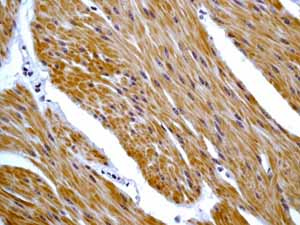 Immunohistochemistry (Formalin/PFA-fixed paraffin-embedded sections) - Anti-Desmin antibody [Y66] - Low endotoxin, Azide free (AB216616)