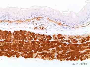 minxfoams様 Anti-Desmin antibody [Y66] - Low endotoxin, Azide free