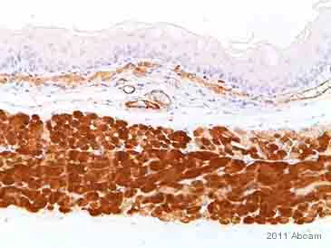 Immunohistochemistry (Formalin/PFA-fixed paraffin-embedded sections) - Anti-Desmin antibody [Y66] - Low endotoxin, Azide free (AB216616)