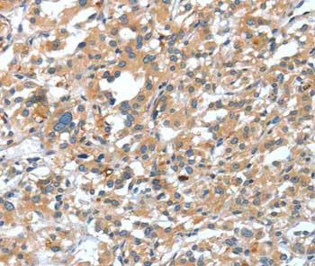 Immunohistochemistry (Formalin/PFA-fixed paraffin-embedded sections) - Anti-Desmocollin 1 antibody (AB198904)