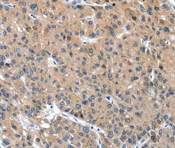 Immunohistochemistry (Formalin/PFA-fixed paraffin-embedded sections) - Anti-Desmocollin 1 antibody (AB198904)
