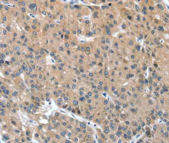 Immunohistochemistry (Formalin/PFA-fixed paraffin-embedded sections) - Anti-Desmocollin 1 antibody (AB198904)