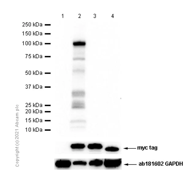 Western blot - Anti-Desmocollin 1 antibody [EPR8220] (AB150382)