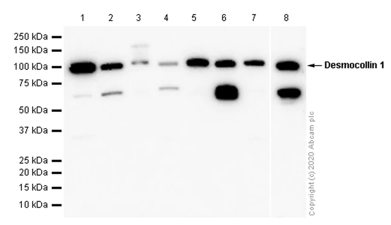 Western blot - Anti-Desmocollin 1 antibody [EPR8220] - BSA and Azide free (AB248954)
