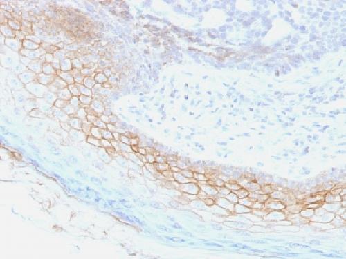 Immunohistochemistry (Formalin/PFA-fixed paraffin-embedded sections) - Anti-Desmocollin 2 antibody [7G6] - BSA and Azide free (AB218849), expandable thumbnail