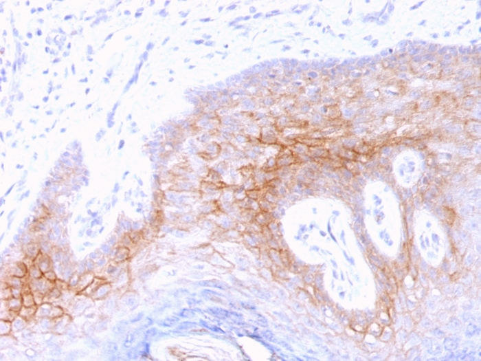 Immunohistochemistry (Formalin/PFA-fixed paraffin-embedded sections) - Anti-Desmocollin 2 antibody [7G6] - Extracellular domain (AB218377), expandable thumbnail