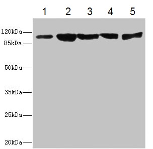Western blot - Anti-Desmocollin 2 antibody (AB230039), expandable thumbnail