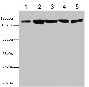 Western blot - Anti-Desmocollin 2 antibody (AB230039)