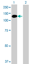 Western blot - Anti-Desmocollin 2 antibody (AB72792)