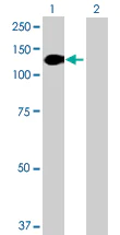 Western blot - Anti-Desmocollin 2 antibody (AB72792)