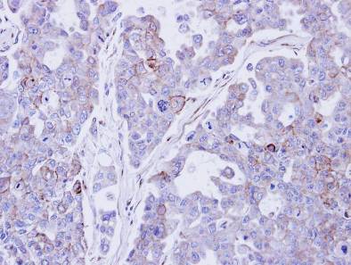 Immunohistochemistry (Formalin/PFA-fixed paraffin-embedded sections) - Anti-Desmocollin 2 antibody (AB95967), expandable thumbnail