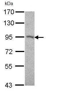 Western blot - Anti-Desmocollin 2 antibody (AB95967), expandable thumbnail