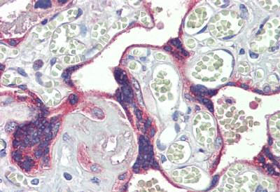 Immunohistochemistry (Formalin/PFA-fixed paraffin-embedded sections) - Anti-Desmocollin 3 antibody - C-terminal (AB190118)