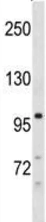Western blot - Anti-Desmocollin 3 antibody - C-terminal (AB190118)