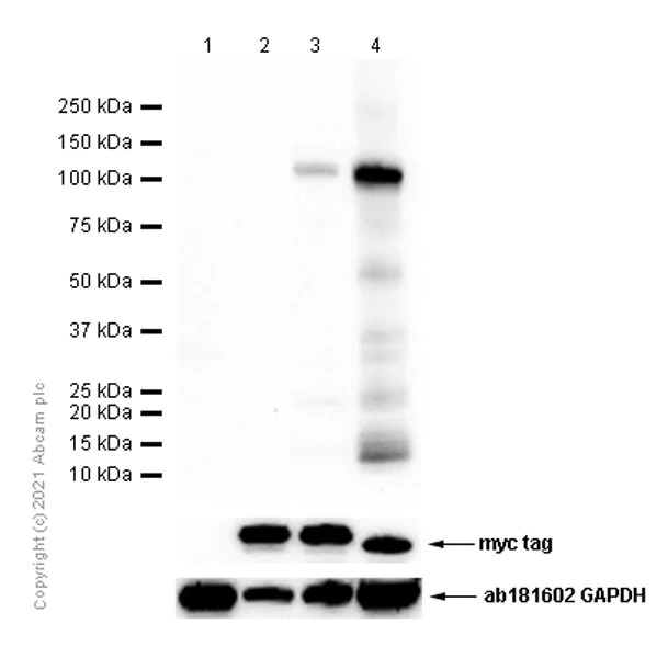Western blot - Anti-Desmocollin 3 antibody [EPR7486] (AB126768)
